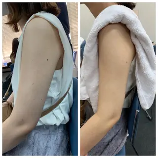 大阪脱毛|ちぇるま| 眉毛Wax｜美肌管理のエステ・リラクイメージ