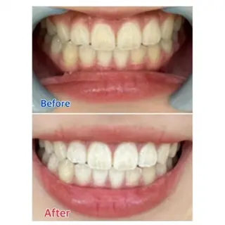 M渋谷店所属・Ｍ渋谷 ホワイトニングのエステ・リラクイメージ