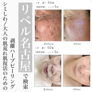 パーマ メンズ マツエク・マツパ 次世代まつげパーマは 『リベル名古屋』のマツエク・マツパデザイン