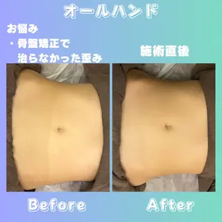 Euphoria所属・肌質改善/都度脱毛 Mahinaのエステ・リラクイメージ