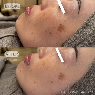 Mau beauty salon所属・Mau (マウ)のエステ・リラクイメージ