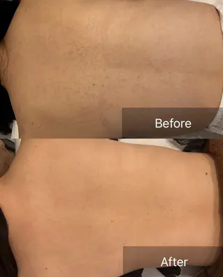 clé skin 🌿ハーブピーリングのエステ・リラクイメージ