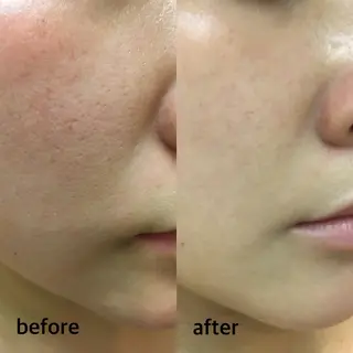 脂肪冷却・脱毛・フェイシャルサロンcoconoix [ｺｺﾉﾜ]所属・脂肪冷却・脱毛サロン coconoix のエステ・リラクイメージ