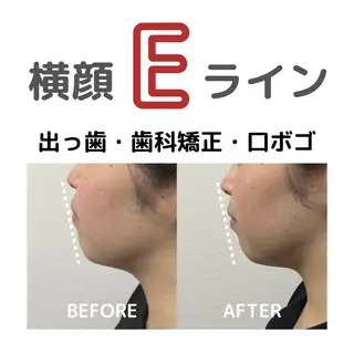 小顔矯正/骨格矯正 AKANEのエステ・リラクイメージ