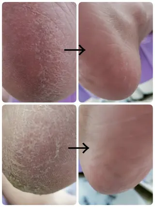 ネイル e.nail所属・和賀井 恵理のネイルデザイン