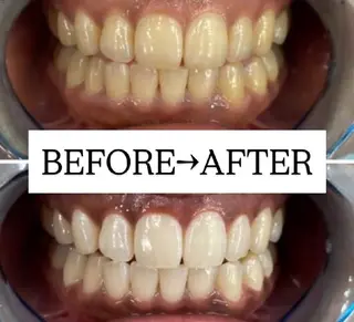 【歯科提携】歯のセルフホワイトニング専門店 セルフホワイトニングサロン宝塚所属・箕浦 乙葉のその他イメージ