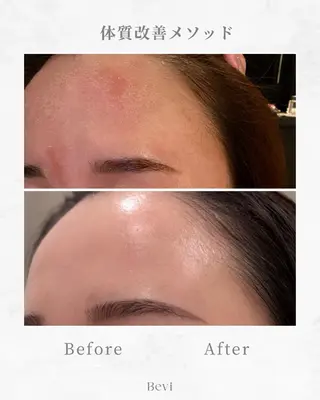 Bevi salonのその他イメージ