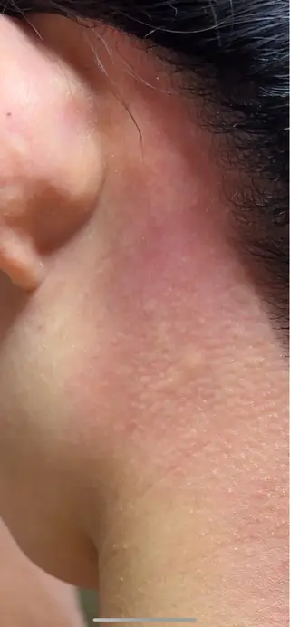 Hit. シュガーリング豊橋のエステ・リラクイメージ