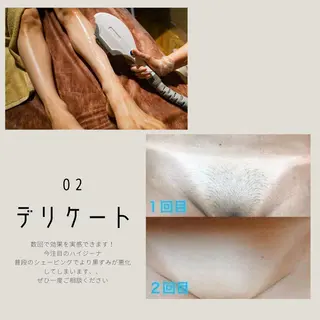 男女同額完全個室脱毛 LEPIA内田のエステ・リラクイメージ