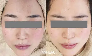 ASHERU* Yuiのエステ・リラクイメージ