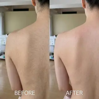 脱毛×肌管理サロン ルネルのエステ・リラクイメージ