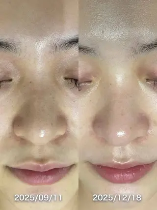 韓国美肌/肌質改善 【天神】yuiのエステ・リラクイメージ