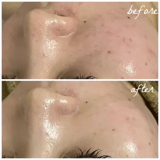 メンズ メナード岐阜茜部 杉浦のエステ・リラクイメージ