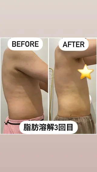 アルカンジュ~archange~所属・痩身/毛穴洗浄/脱毛 アルカンジュのエステ・リラクイメージ