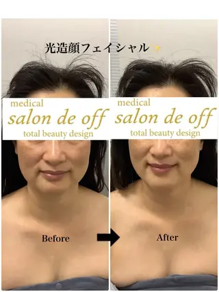 🩵Tatsumi Kana🩵のエステ・リラクイメージ