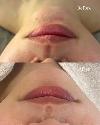 BELLIS HUIT所属・ハーブピーリング那覇 BELLISHUITのエステ・リラクイメージ