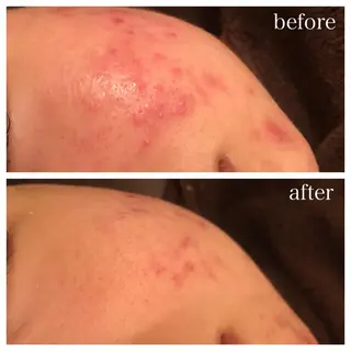 セミロング カラー パーマ キッズ ネイル マツエク・マツパ ニキビ跡専門サロン Ａｉｎａのエステ・リラクイメージ