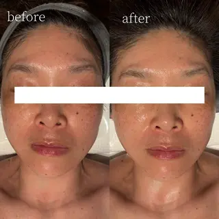 Erika komorebi_のエステ・リラクイメージ