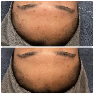 yellow.所属・yellow💛【 脱毛&フェイシャル】のエステ・リラクイメージ