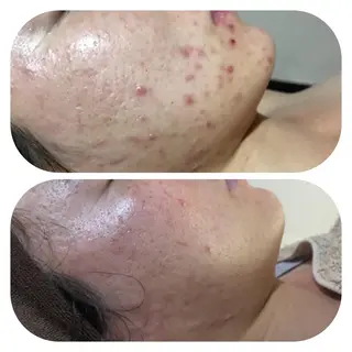 【足圧】鬼👹リンパ 身体整うサロンのエステ・リラクイメージ