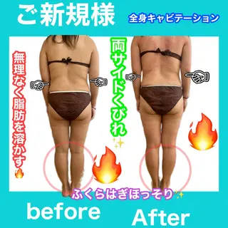 痩身/脱毛/ネイル HARUKAのエステ・リラクイメージ