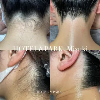 HOTEL&PARK . ワックス脱毛のエステ・リラクイメージ