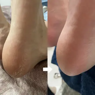 トータルビューティvivie(ビビィ)所属・たちばな ✋🦶💆‍♀️のネイルデザイン