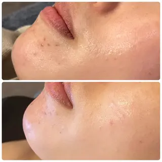 yellow.所属・yellow💛【 脱毛&フェイシャル】のエステ・リラクイメージ