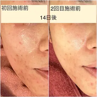 Melyssa🌿所属・Melyssa🌿 メリッサのエステ・リラクイメージ