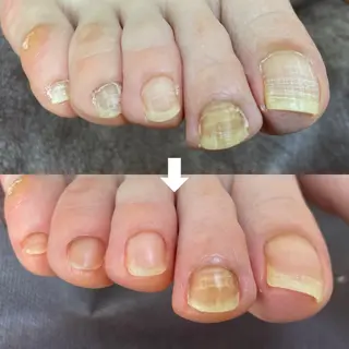 トータルビューティvivie(ビビィ)所属・たちばな ✋🦶💆‍♀️のネイルデザイン