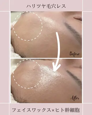 Detox Salon〜Lani Blue〜所属・土田 遥菜のエステ・リラクイメージ