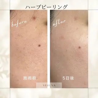 ピーリング専門店 Belluteのエステ・リラクイメージ