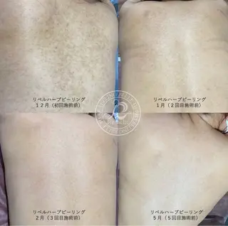 SALON BioBioのエステ・リラクイメージ