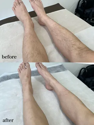 メンズ 瀬戸 梨子のエステ・リラクイメージ