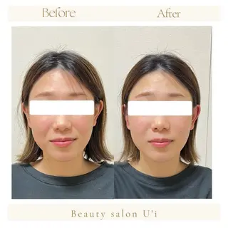 頭蓋骨小顔矯正 藤本のエステ・リラクイメージ