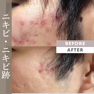 メンズ Ganesa Fusion Studio所属・井上 みあのエステ・リラクイメージ