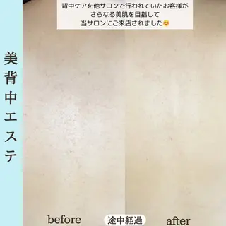 ベラージュ【美背中・ 美尻・フェイシャル】のエステ・リラクイメージ