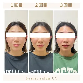 頭蓋骨小顔矯正 藤本のエステ・リラクイメージ