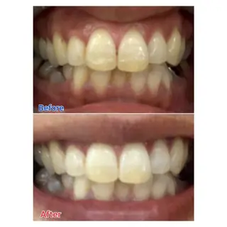 MBEAUTYSALON 千葉店・京成大久保所属・Melty 輝のその他イメージ