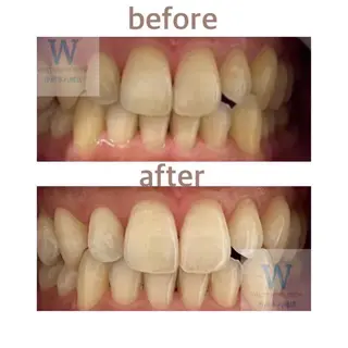 ホワイトニング ショップ本八幡店のエステ・リラクイメージ