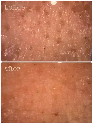 POLA THE BEAUTY 堺東店所属・肌管理🌿毛穴改善 POLA堺東のエステ・リラクイメージ