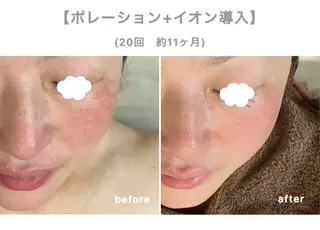 【Folche 春日店】馬場・大内田のエステ・リラクイメージ