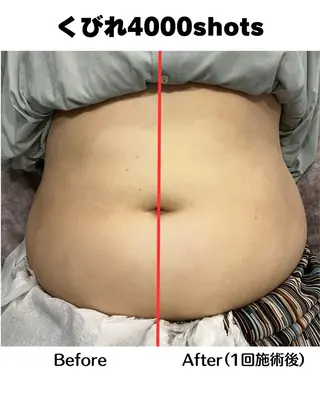 Clear Canvasのエステ・リラクイメージ