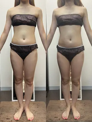 ハイパーナイフ専門店　Salon de COCO所属・Salon de COCOのエステ・リラクイメージ