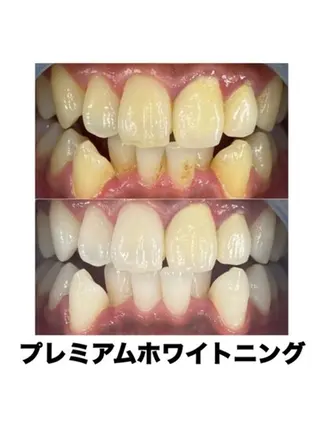 ホワイトニングカフェ藤が丘店所属・ホワイトニングカフェ 藤が丘のその他イメージ