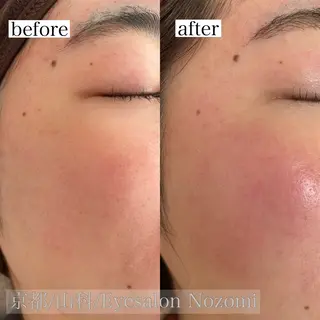 Eyesalon Nozomiのマツエク・マツパデザイン