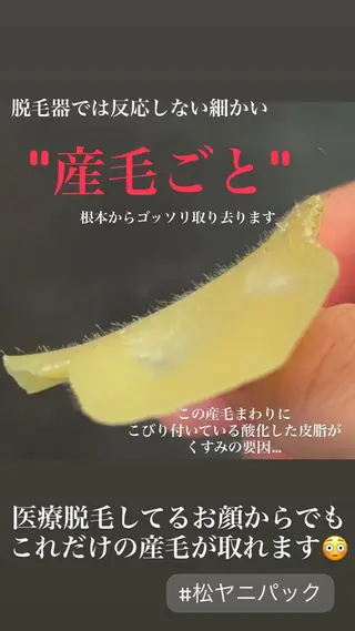 HINA/産毛脱毛・ 肌質改善専門サロンのエステ・リラクイメージ