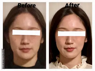 小顔矯正Sho  FaceDesignのエステ・リラクイメージ