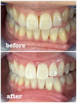 セルフホワイトニング エクシア徳島店マユのその他イメージ