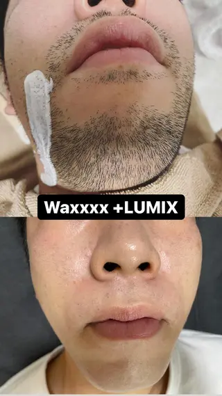 メンズ Epina 千葉店 【エピナ】のエステ・リラクイメージ